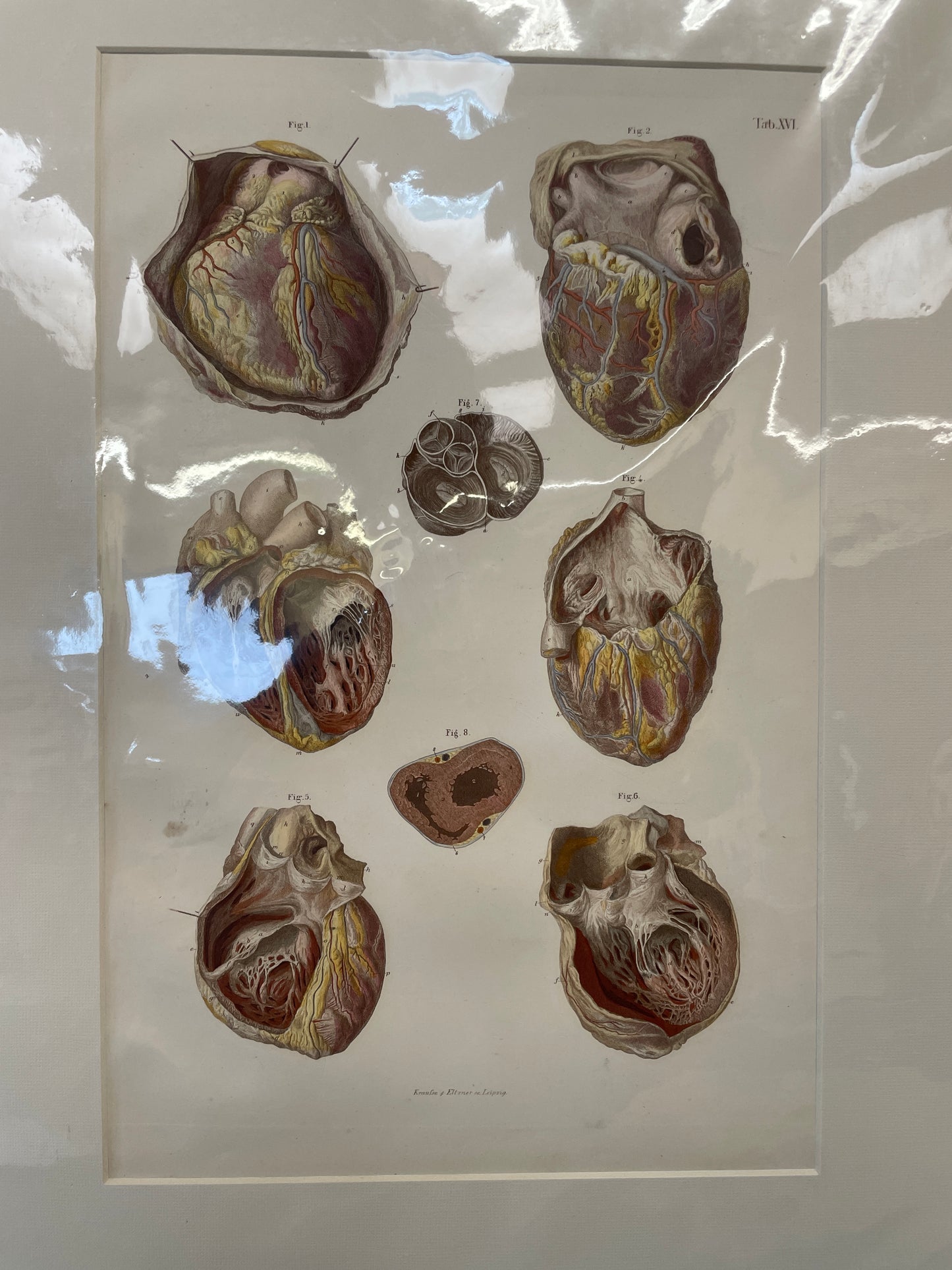 Heart 11-474 - print